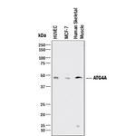 ATG4A Polyclonal Antibody