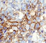 CD109 Polyclonal Antibody