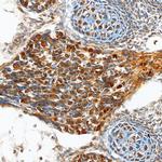 TENM2 Polyclonal Antibody