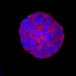 ESGP Antibody in Immunocytochemistry (ICC/IF)