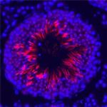 ESGP Antibody in Immunohistochemistry (Frozen) (IHC (F))