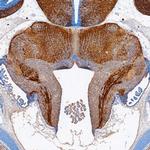 ISLR2 Polyclonal Antibody