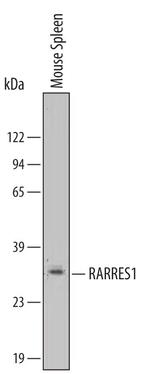 RARRES1 Polyclonal Antibody