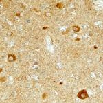LTK Antibody in Immunohistochemistry (Paraffin) (IHC (P))