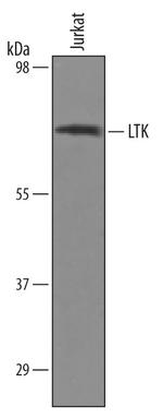 LTK Antibody in Western Blot (WB)