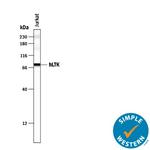 LTK Antibody in Western Blot (WB)