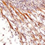 Neurturin Polyclonal Antibody