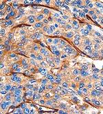 CLEC14A Antibody in Immunohistochemistry (Paraffin) (IHC (P))