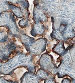 5T4 Antibody in Immunohistochemistry (Paraffin) (IHC (P))