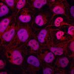 ZIC1 Polyclonal Antibody