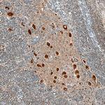 LRRC3 Polyclonal Antibody