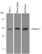 Ninjurin 2 Antibody in Western Blot (WB)