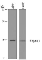 Ninjurin 1 Antibody in Western Blot (WB)
