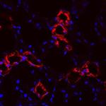 Uromodulin Polyclonal Antibody