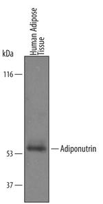 PNPLA3 Antibody in Western Blot (WB)