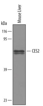 CES2 Polyclonal Antibody