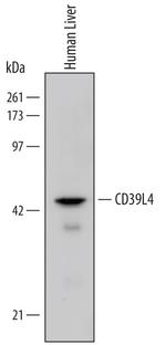 ENTPD5 Polyclonal Antibody