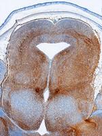 PLXNC1 Polyclonal Antibody