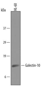 Galectin 10 Polyclonal Antibody