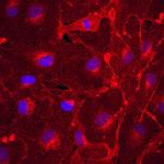 Plexin A2 Antibody in Immunocytochemistry (ICC/IF)