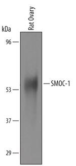 SMOC1 Polyclonal Antibody
