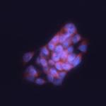 SLAIN1 Polyclonal Antibody
