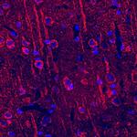 Neuropilin 2 Polyclonal Antibody