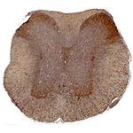 GFRAL Polyclonal Antibody