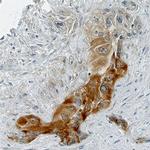 BTF3 Polyclonal Antibody