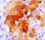 ING1 Antibody in Immunohistochemistry (Paraffin) (IHC (P))