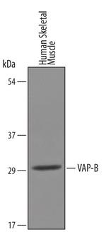 VAPB Antibody in Western Blot (WB)