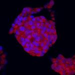 SEMA5A Antibody in Immunocytochemistry (ICC/IF)
