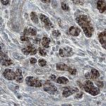 SEMA5A Antibody in Immunohistochemistry (Paraffin) (IHC (P))