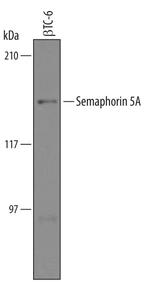 SEMA5A Antibody in Western Blot (WB)