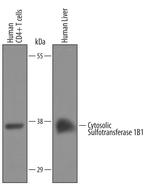SULT1B1 Polyclonal Antibody