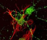 Ephrin A2 Antibody in Immunocytochemistry (ICC/IF)