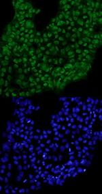TCF7L1 Polyclonal Antibody