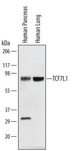 TCF7L1 Antibody in Western Blot (WB)
