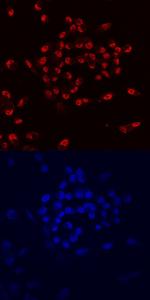 PTF1A Antibody in Immunocytochemistry (ICC/IF)