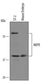 MEPE Polyclonal Antibody