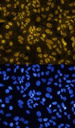 TWIST1 Polyclonal Antibody