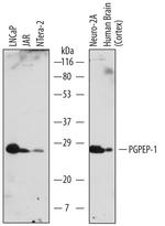 PGPEP1 Polyclonal Antibody