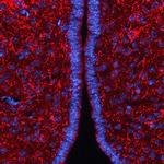 AgRP Polyclonal Antibody