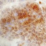 FOXK1 Polyclonal Antibody