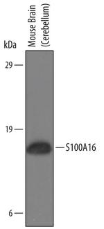 S100A16 Polyclonal Antibody