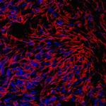 PRELP Polyclonal Antibody