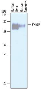 PRELP Antibody in Western Blot (WB)