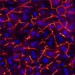 CEACAM1 Polyclonal Antibody