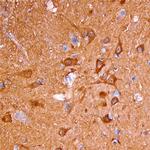 Neurocan Polyclonal Antibody