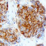 LY6K Polyclonal Antibody